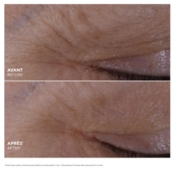 DOUBLE SERUM Eye Brightening + Depuffing Anti-Aging Concentrate 3