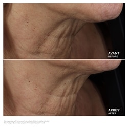Extra-Firming Neck & Décolleté Anti-Aging Care 3