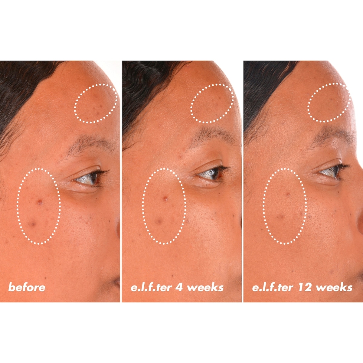 Bright Icon Vitamin C + E + Ferulic Serum