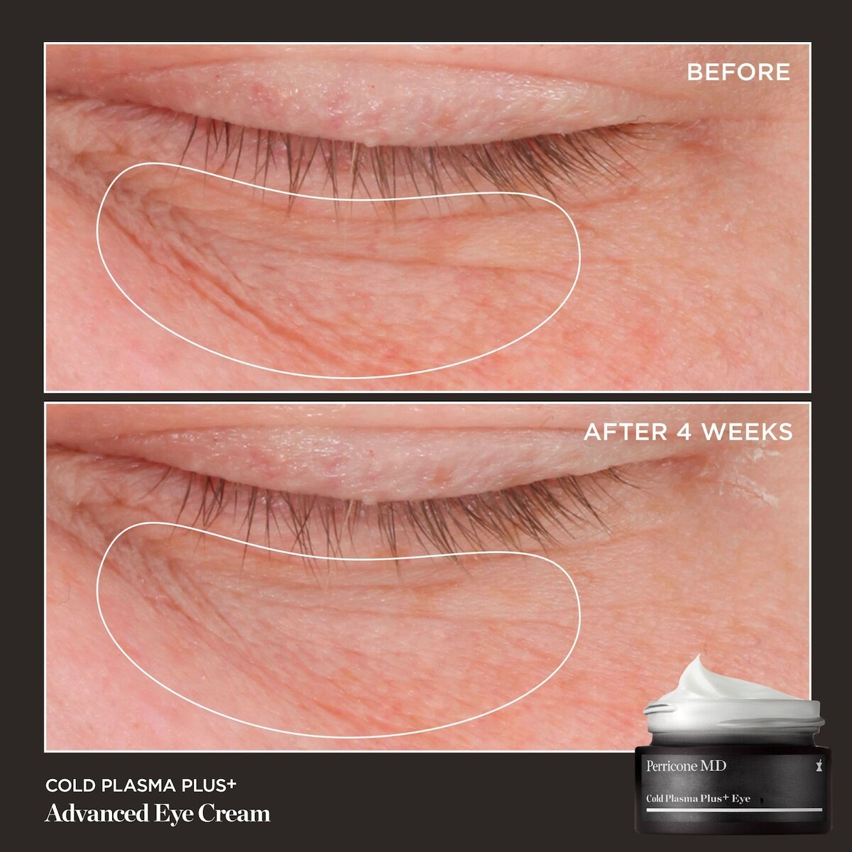 Cold Plasma Plus+ Crème Avancée  Contour des Yeux