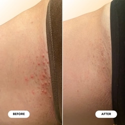 Ingrown Hair Oil - Vanilla Tangerine 6