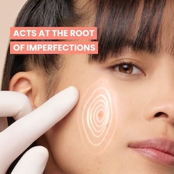 Cleanance Comedomed+ Intensive Anti-Blemish Care - for Pimples, Blackheads, Marks - Oily acne-prone skin 4