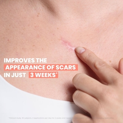 Cicalfate+ Remodeling Scar Gel, with 25% Dermo-silicone Complex - for post-procedures wound healing 3