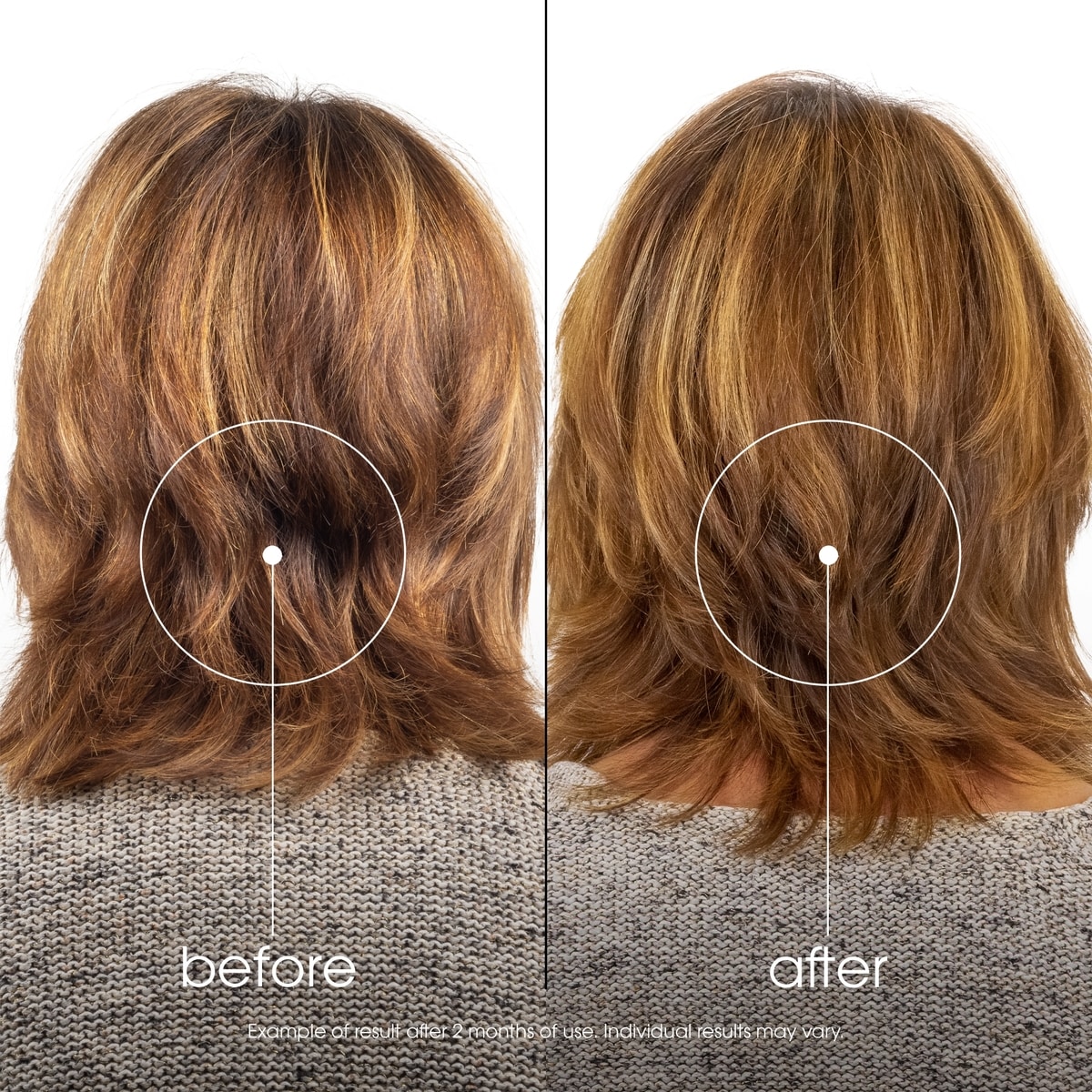 Conditioner with Quinine & ORGANIC Edelweiss - Strengthening for thinning hair