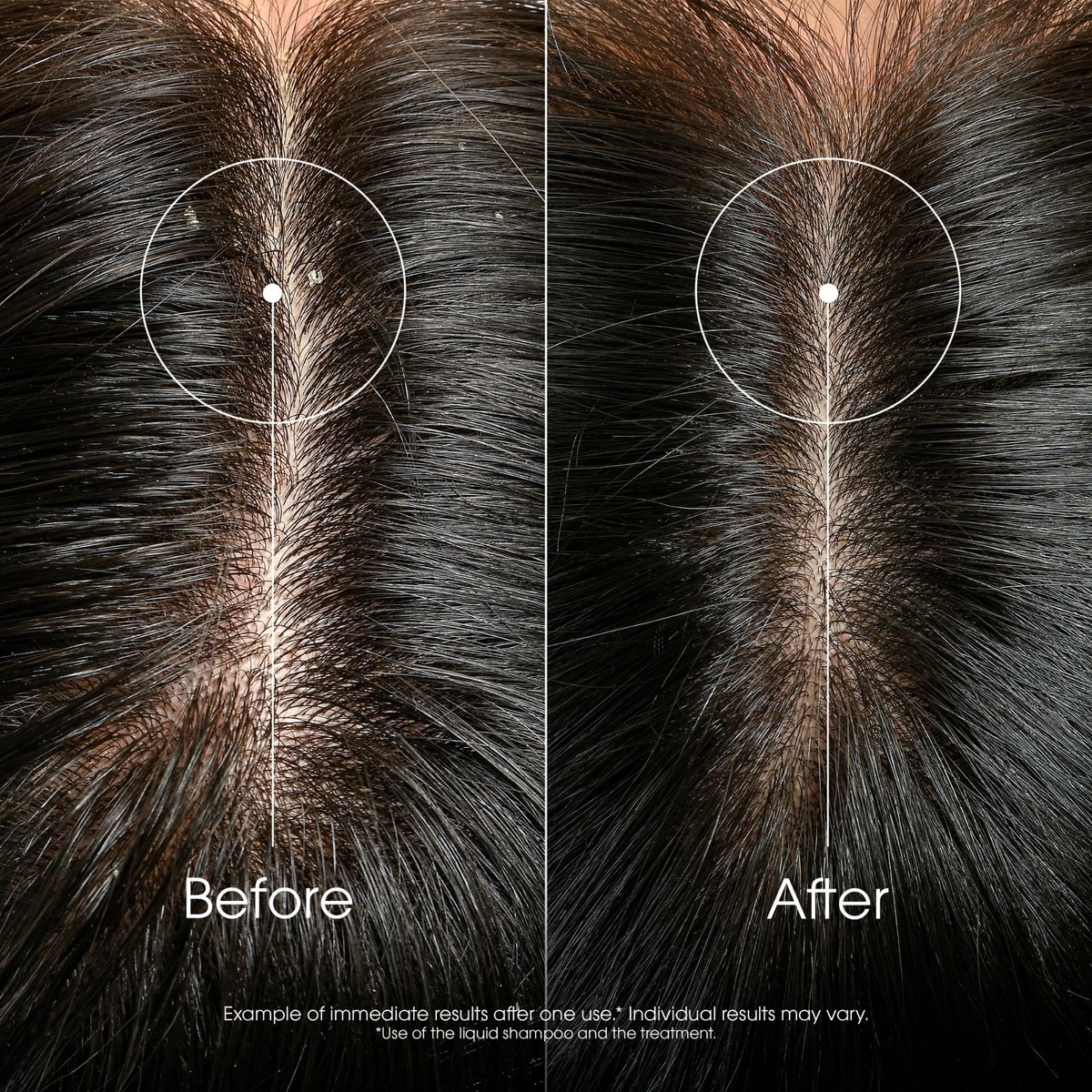 Rebalancing & Neutralizing Shampoo with Galangal - Anti-Loose Dandruff - High tolerance formula