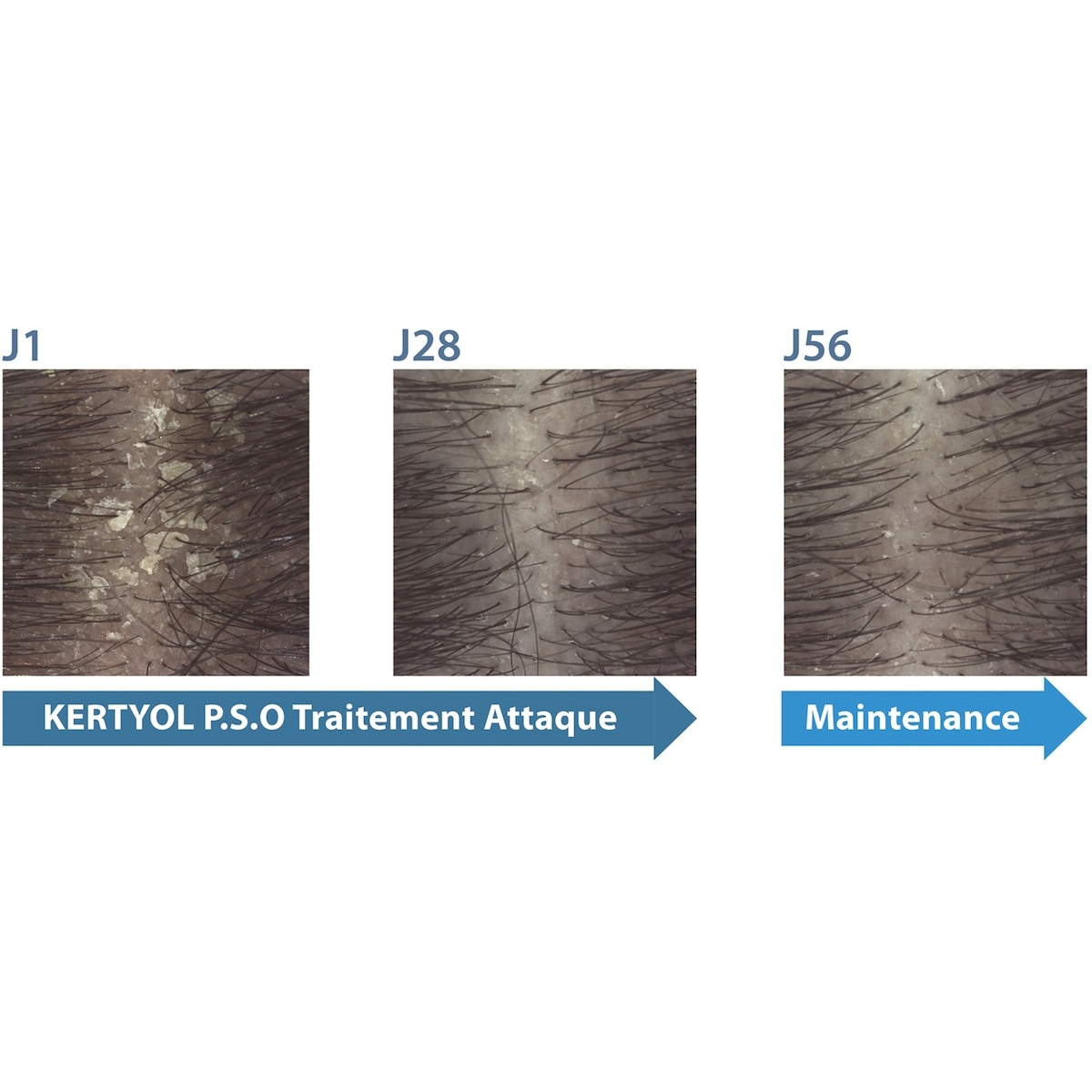 Kertyol PSO shampooing