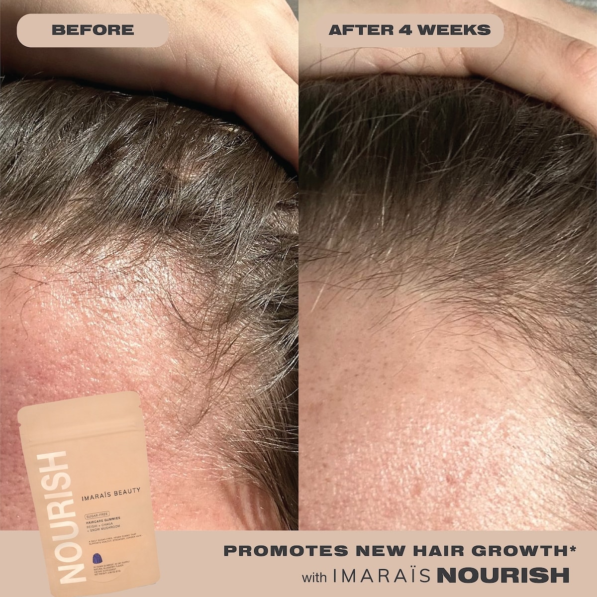 NOURISH Haircare Gummies for Hair Growth, Anti-Shedding