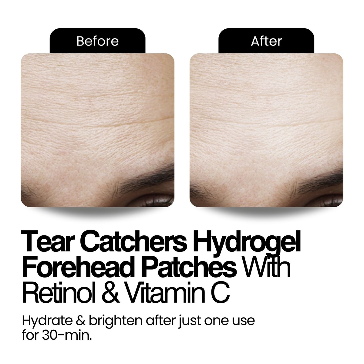 Tear Catchers Hydrogel Wrinkle & Stress-Relief Forehead & Eye Therapy Kit with Retinol & Vitamin C (x2 sets)
