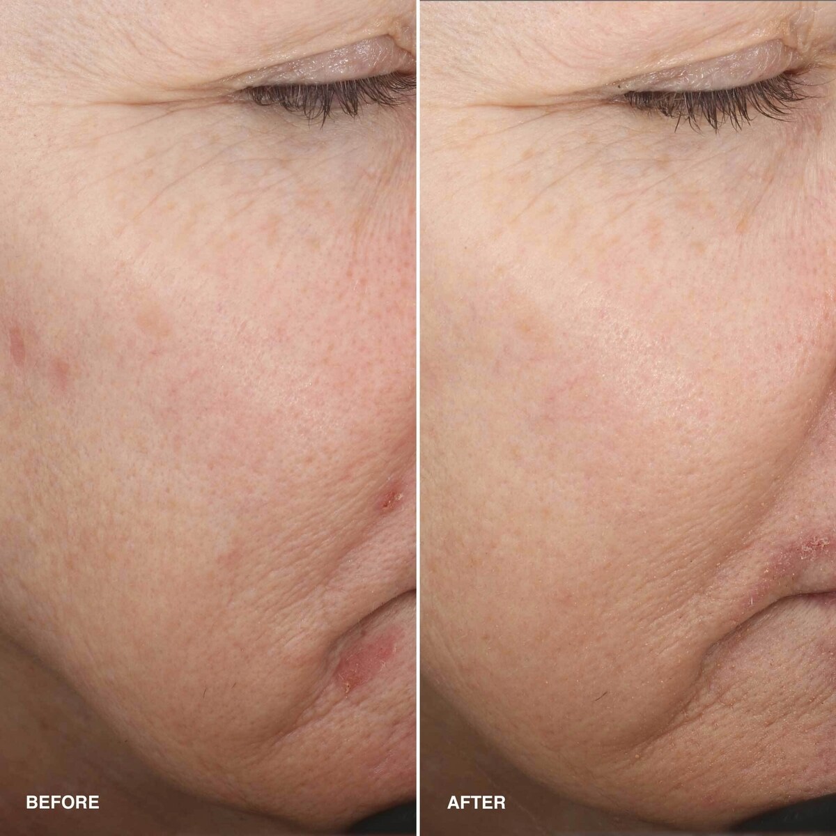 Vitamin Enriched Smoothing Serum