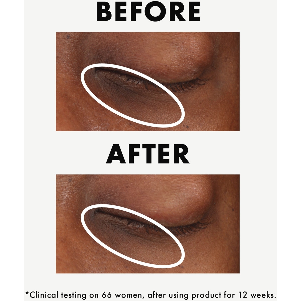 Ginzing™ Vitamin C Eye Cream To Brighten And Depuff