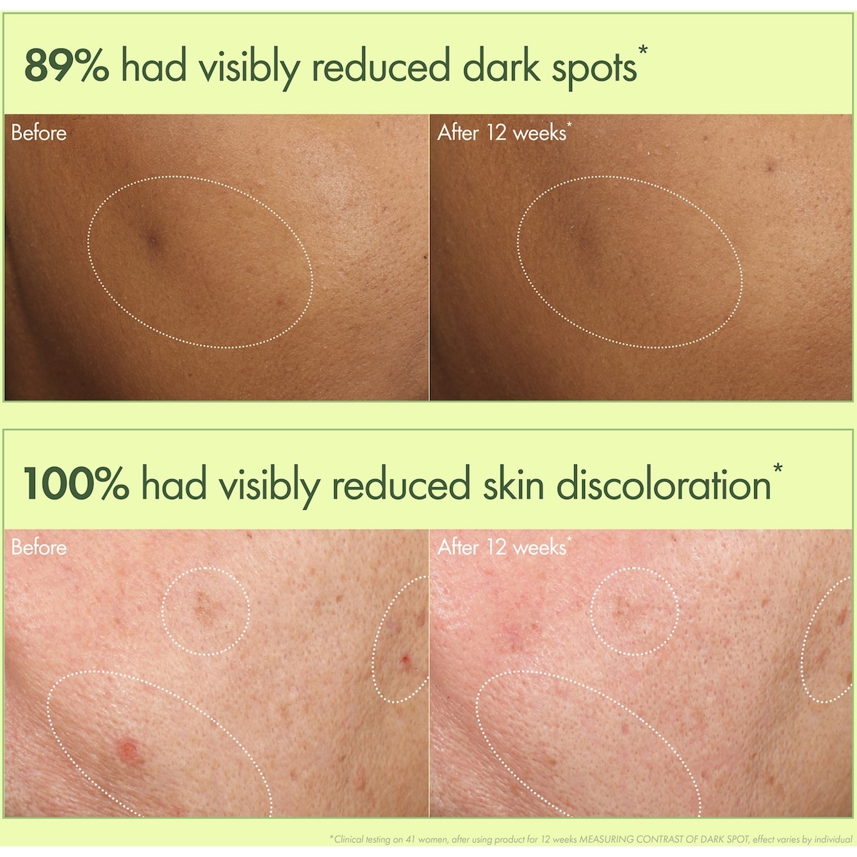 Dr. Andrew Weil for Origins™ Mega-Mushroom Dark Spot Brightening Serum