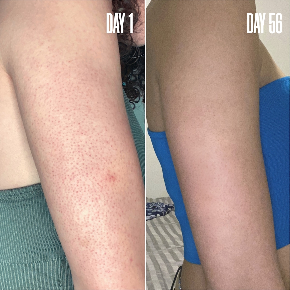 RE-START Resurfacing Body Serum