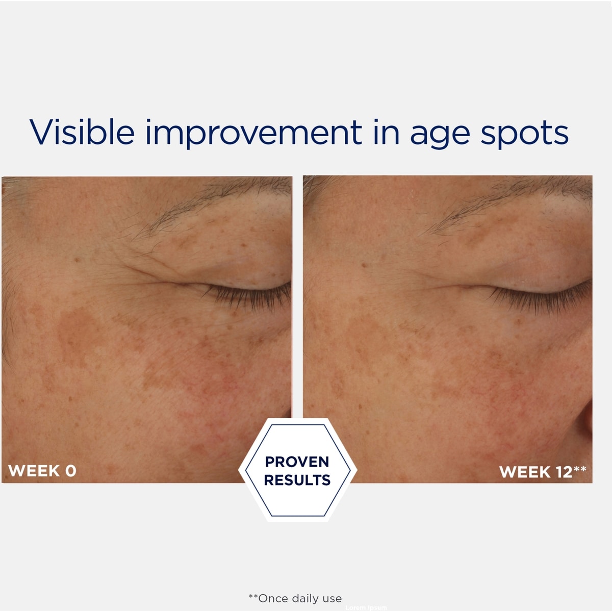 Potent Retinol Complex