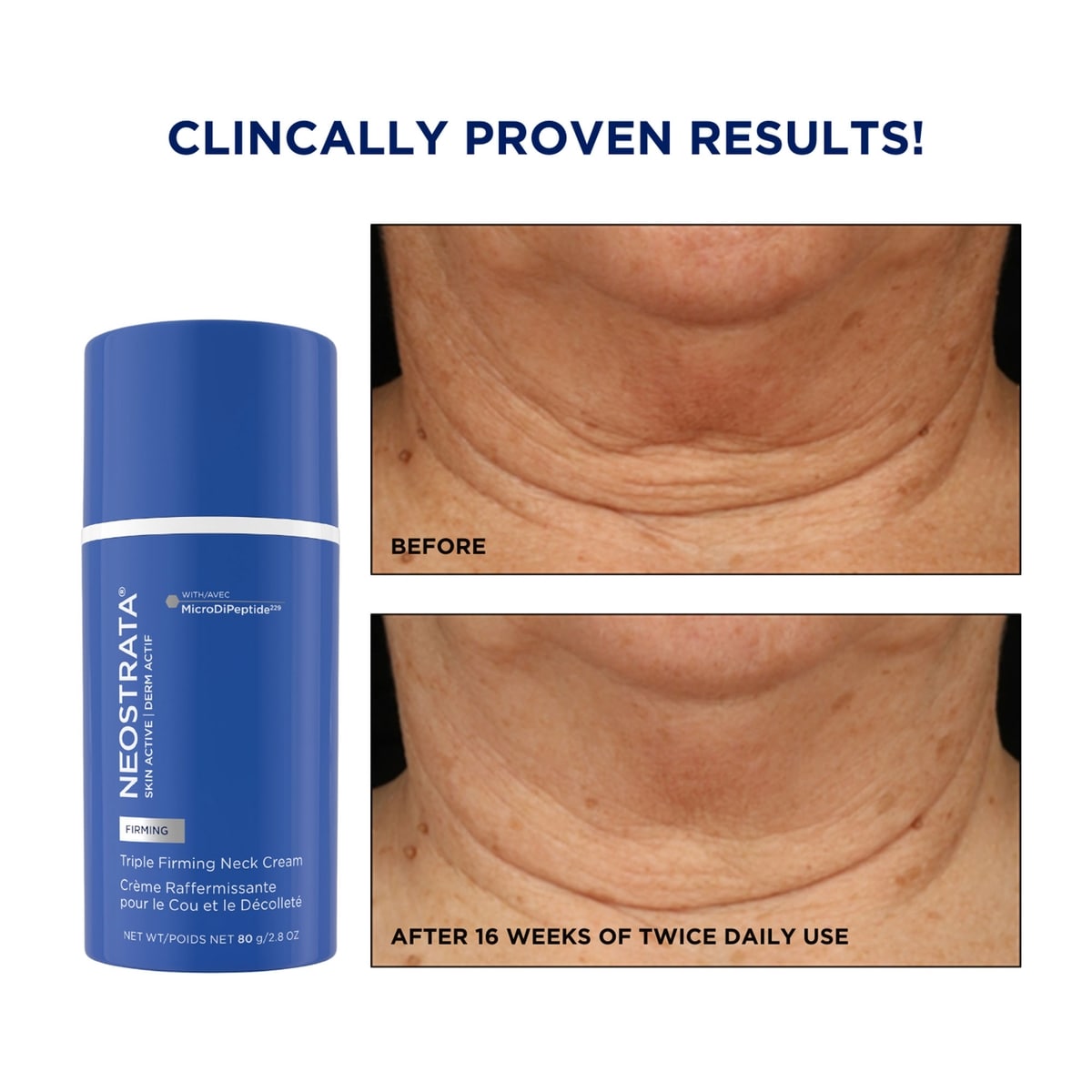 Neostrata Skin Active Lift & Renew Trio | Shoppers Drug Mart