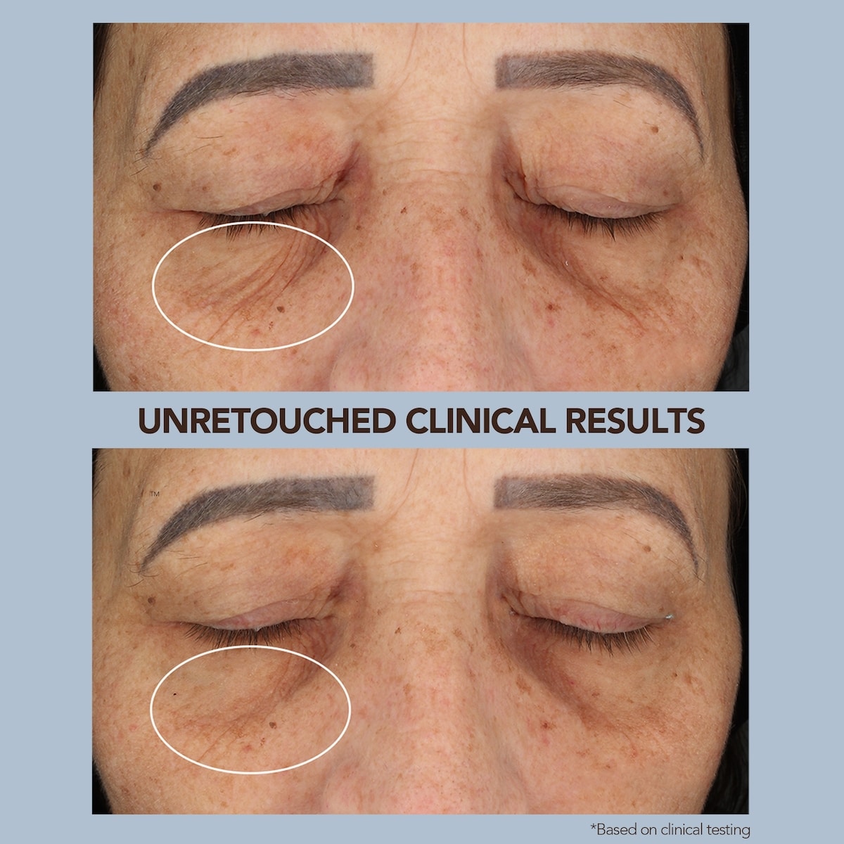 BEAR 2 Fuchsia Advanced Microcurrent Facial Toning Device