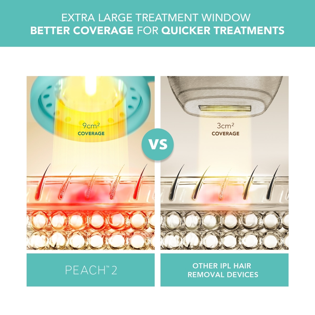 PEACH 2 Mint & PEACH Cooling Prep Gel Bundle