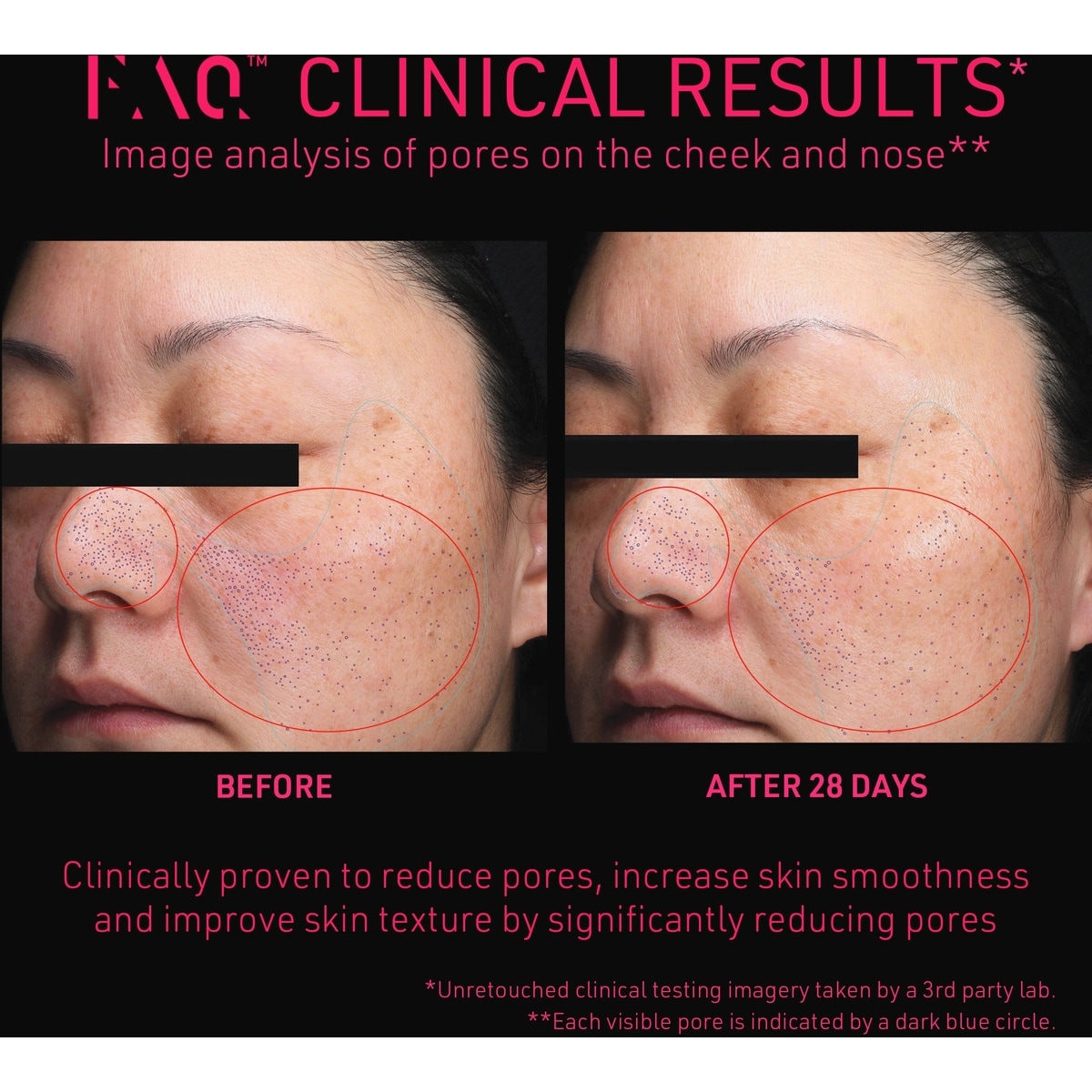 FAQ™ 102 Rajeunissement facial professionnel par radiofréquence