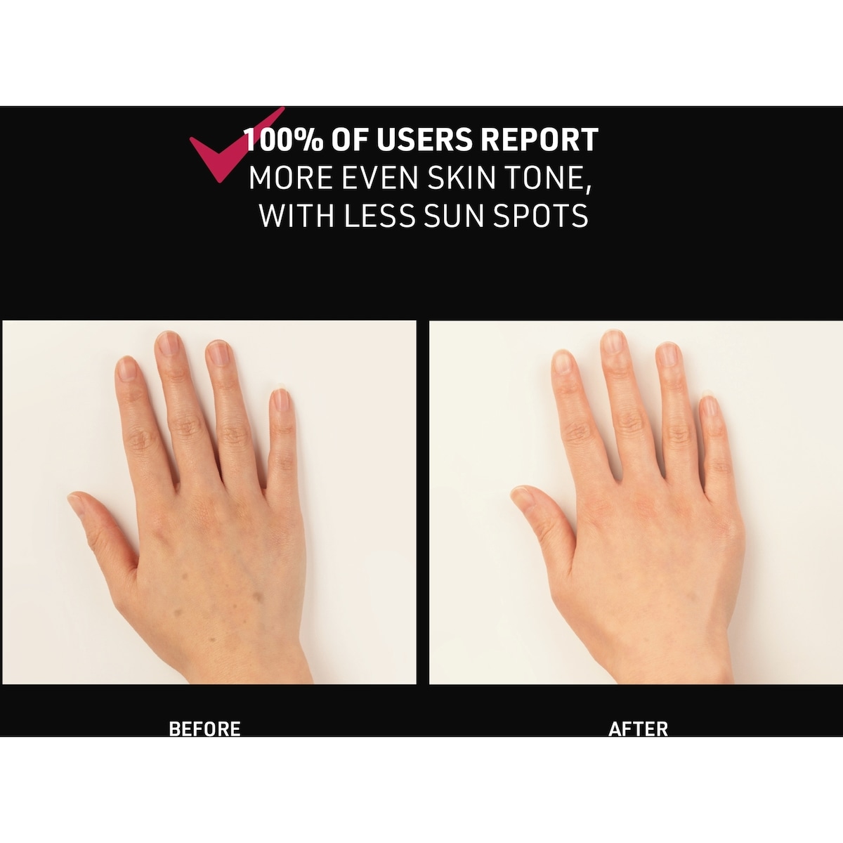 FAQ™ 221 Silicone LED + Near-Infrared Hand Mask