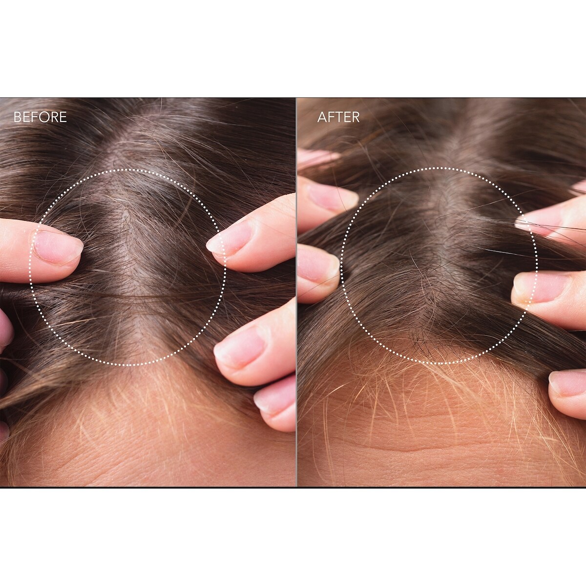 FAQ™ Sérum probiotique pour la récupération du cuir chevelu et les cheveux épais