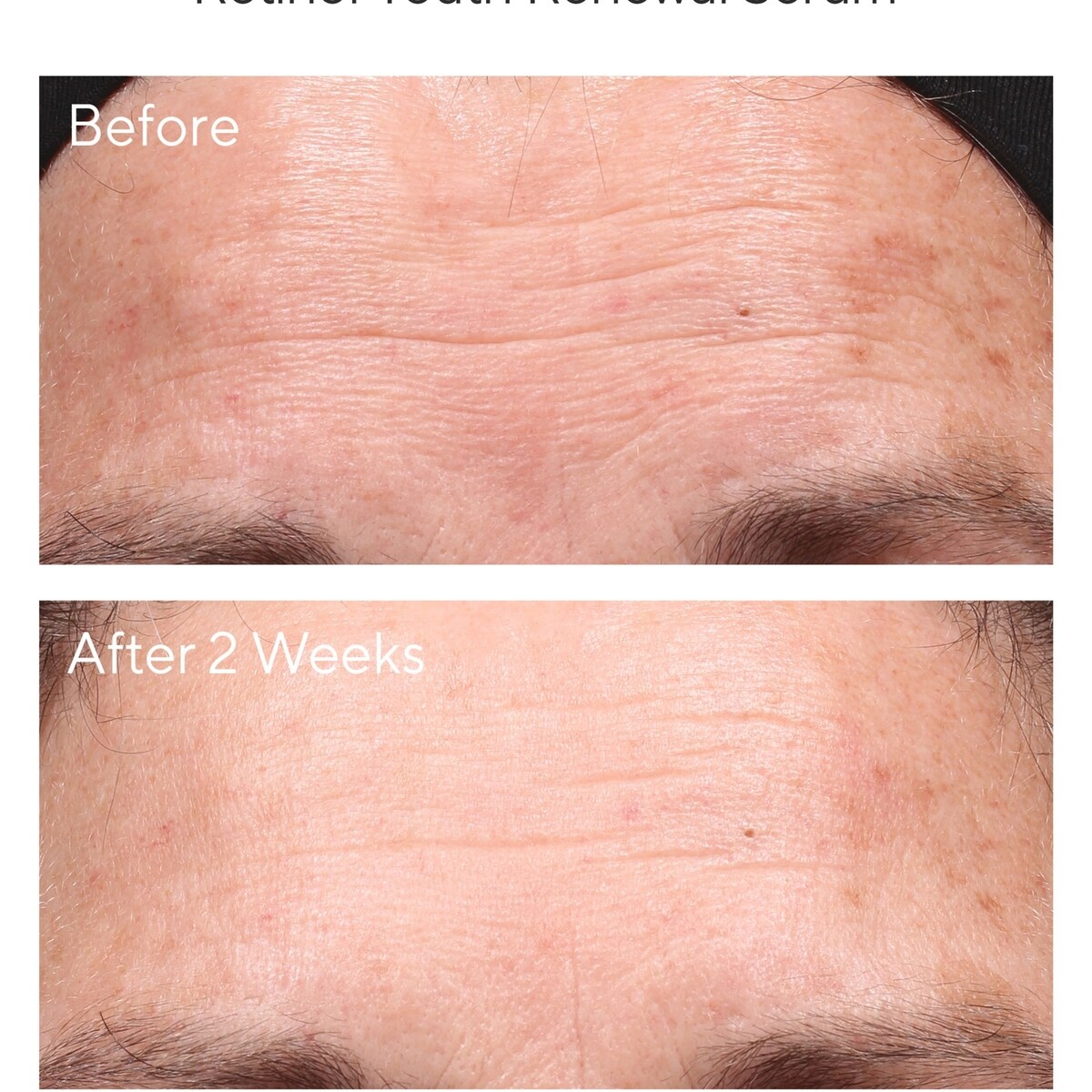 Serum rajeunissant au retinol