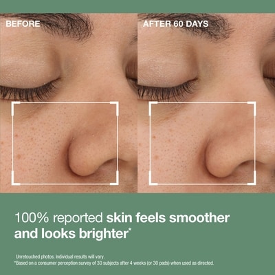 Daily Reveal™ Exfoliating Pads 4