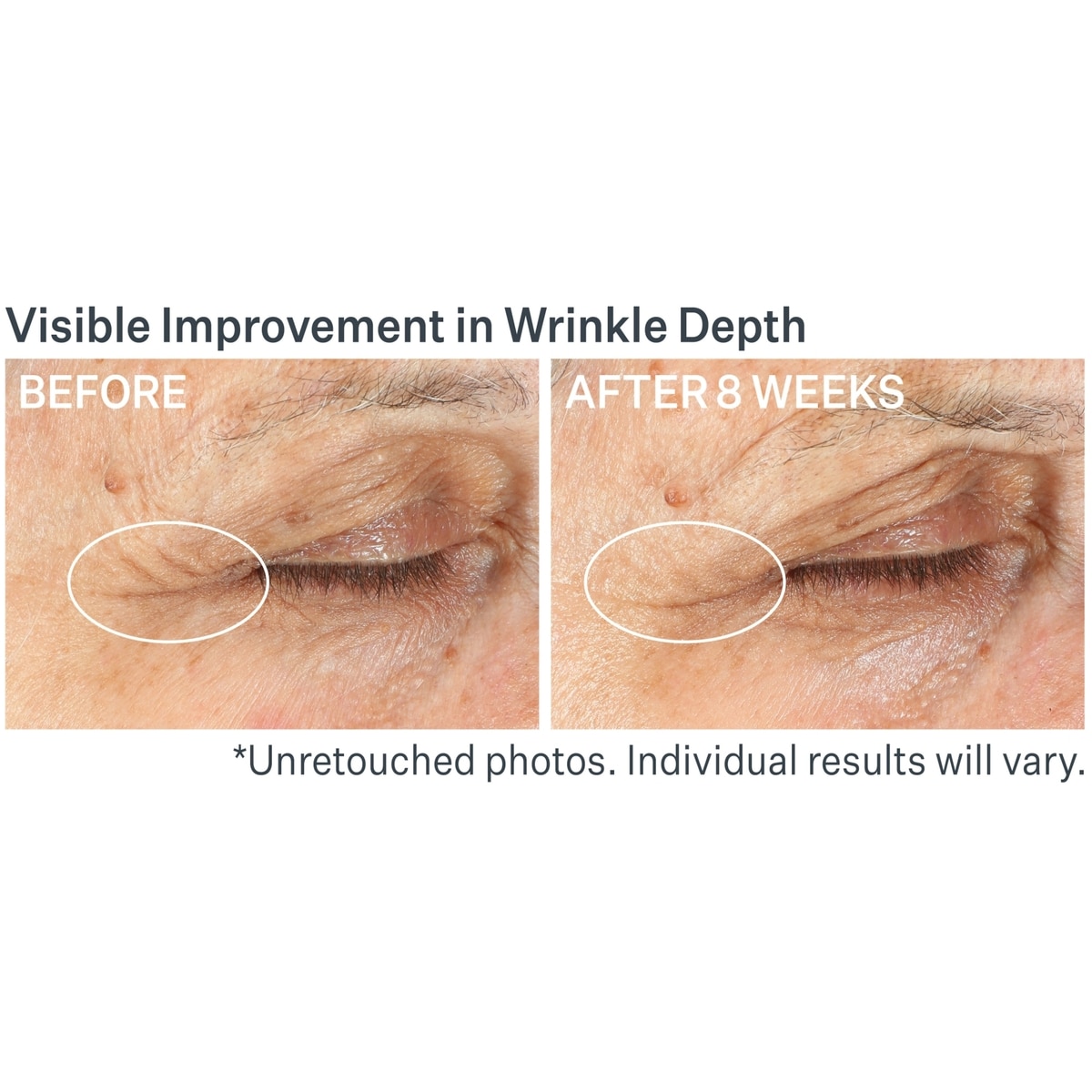 Advanced Retinol Multi-Correct Eye Cream