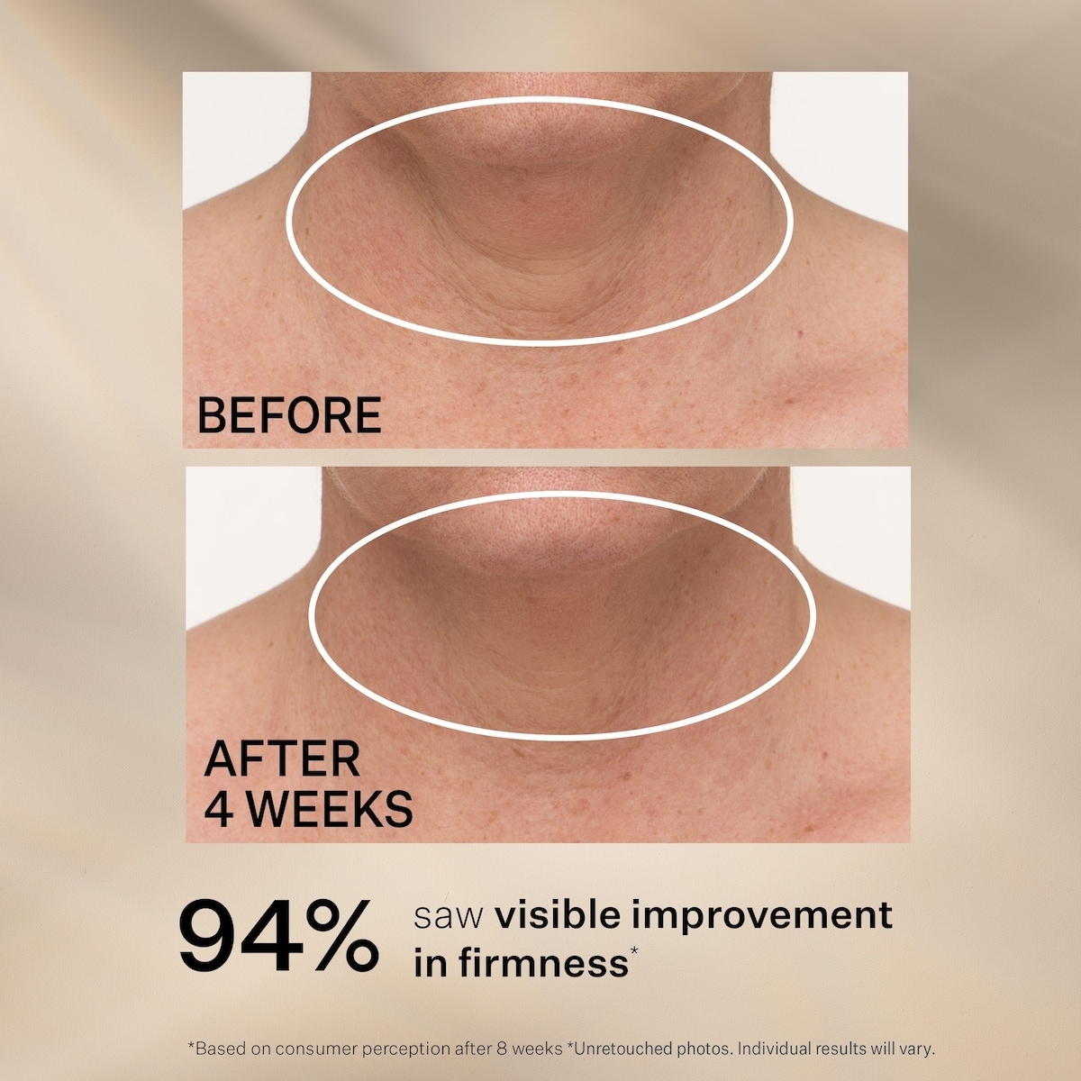 TL Advanced™ CRÈME RAFFERMISSANTE POUR LE COU