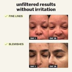 beginner retinol gel 4