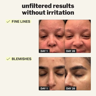 beginner retinol gel 4
