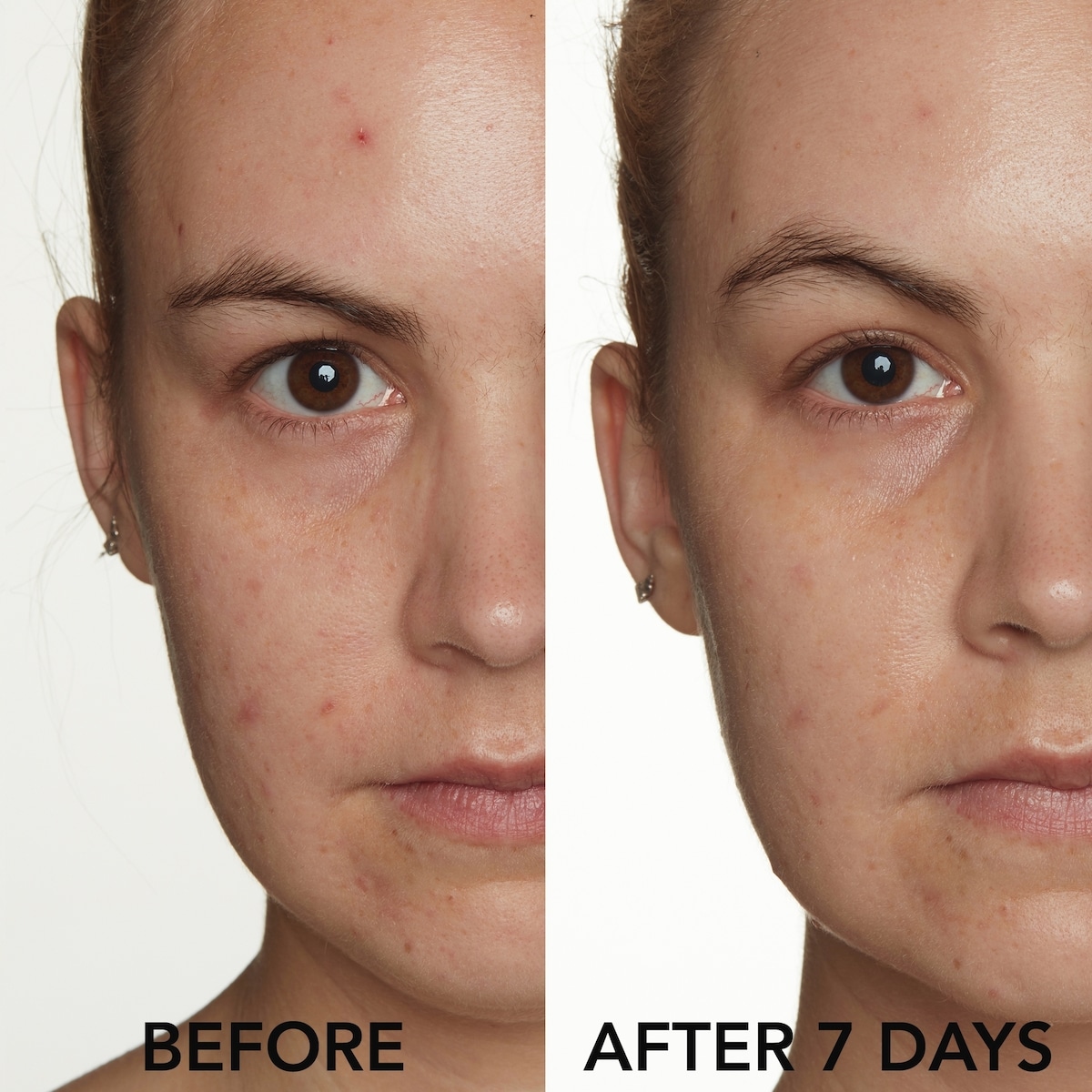 SOLUTION CLARIFIANTE avec 10 % de Soufre + Argile Verte