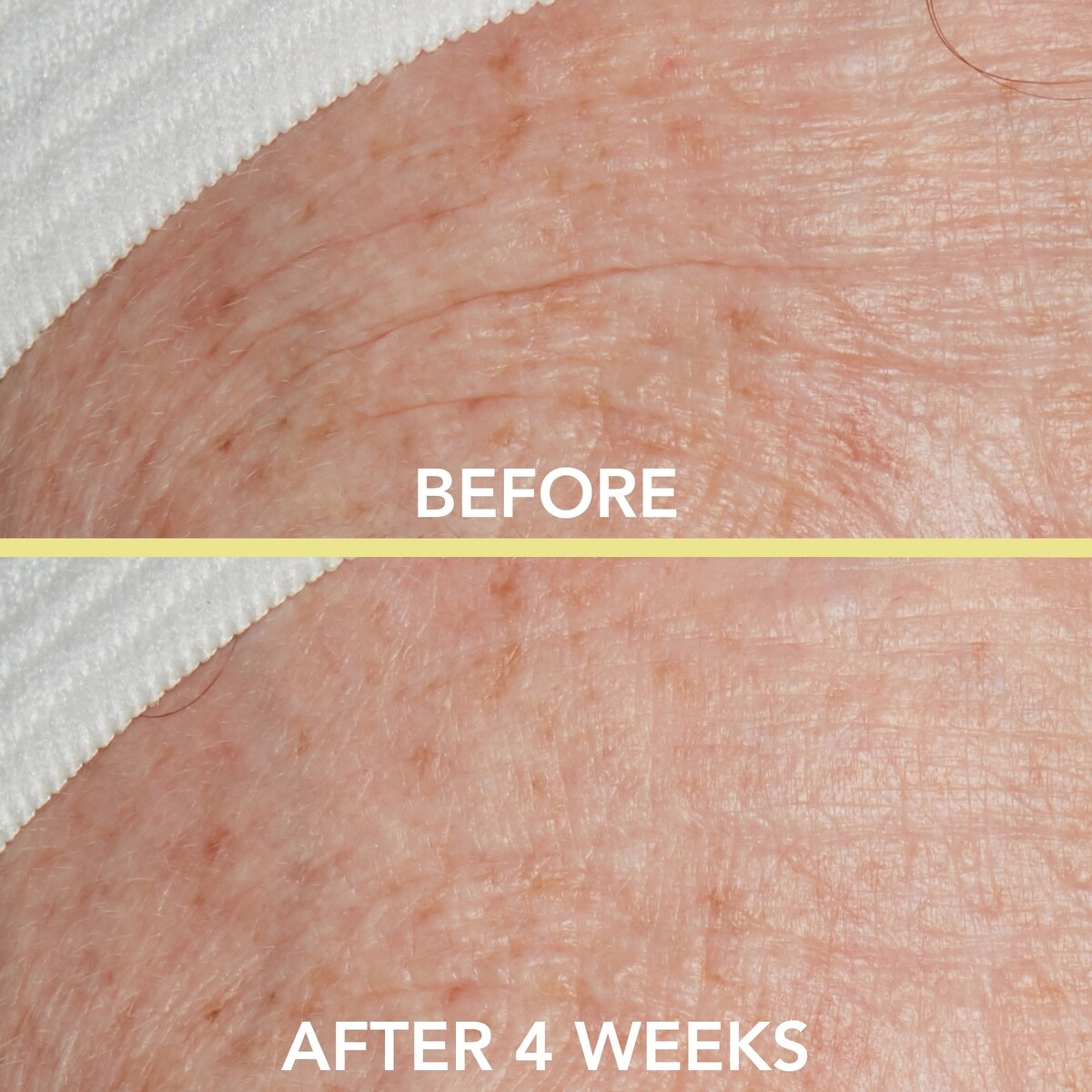 Gouttes aux trois peptides avec Vitamine E + Niacinamide