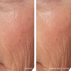 Redness Relief Intense with Manuka Honey 3