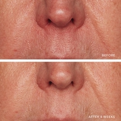 Redness Relief Intense with Manuka Honey 4