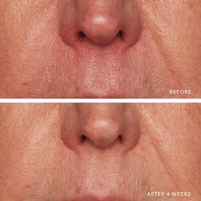 Redness Relief Intense with Manuka Honey 4
