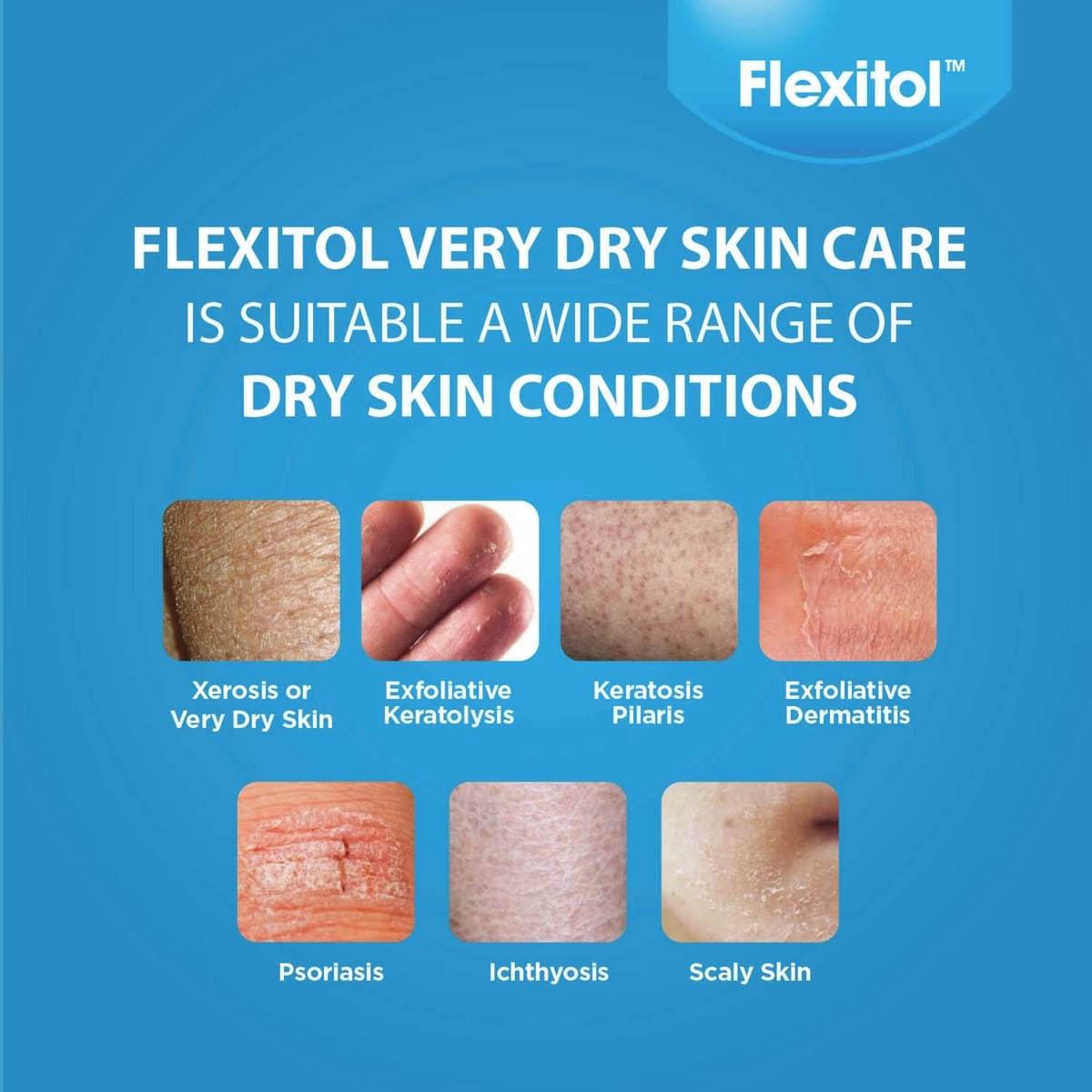 Very Dry Skin Lotion