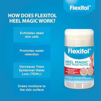 Heel Magic 70 g 3