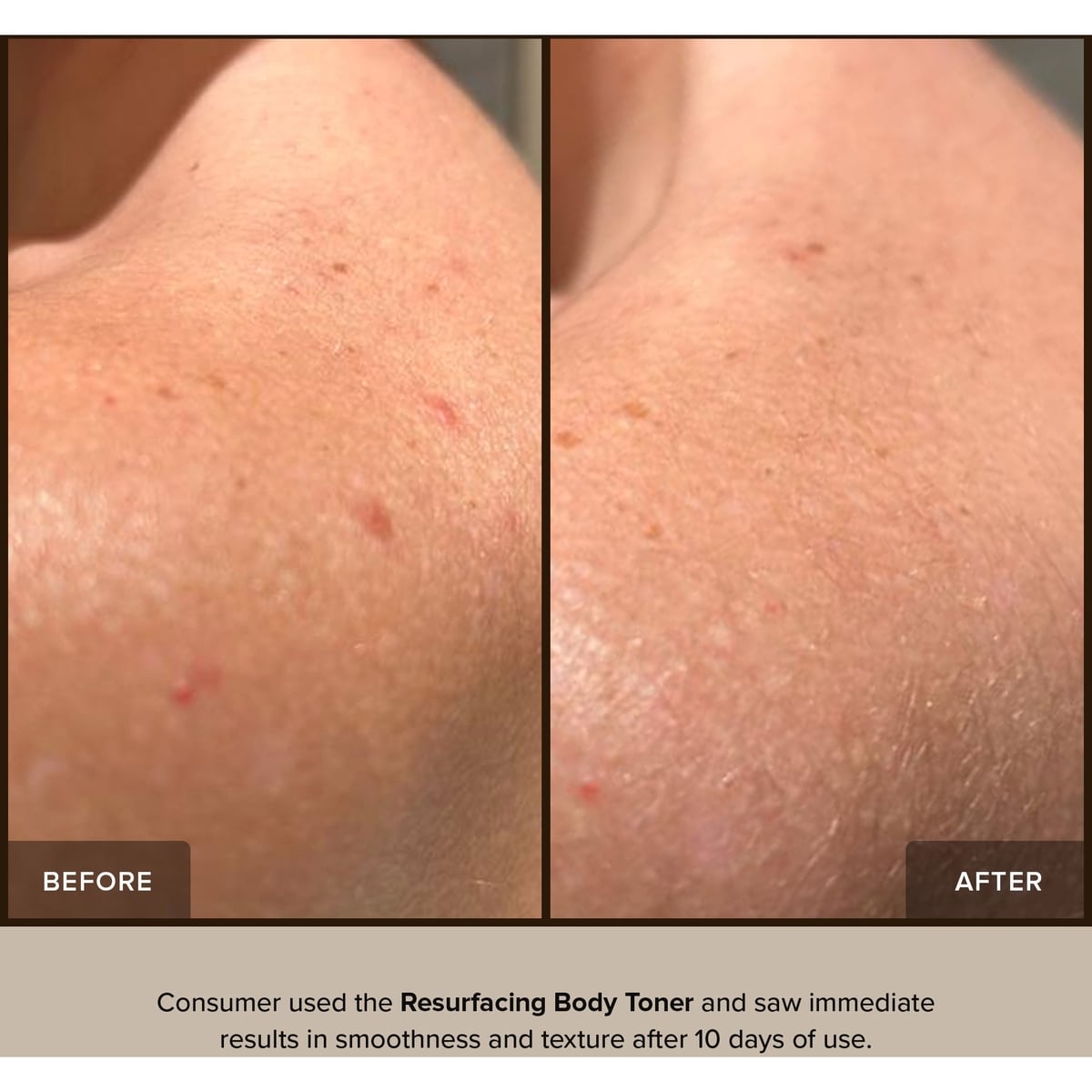 Resurfacing Body Toner