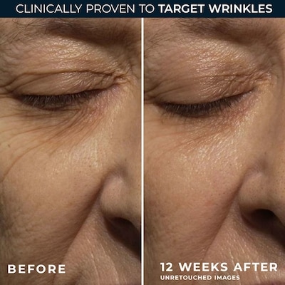 Retinol Correxion Deep Wrinkle Night Cream 30Ml 4