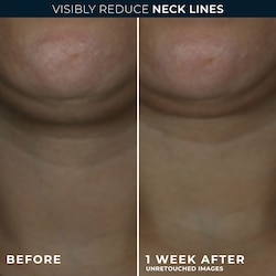 Derm Correxion® Neck Cream With Hyaluronic Acid And Advanced Retinol To Visibly Tighten & Lift Horizontal Neck Lines, Facial Moisturiser To Contour Face, Neck And Jawline, 50Ml 4
