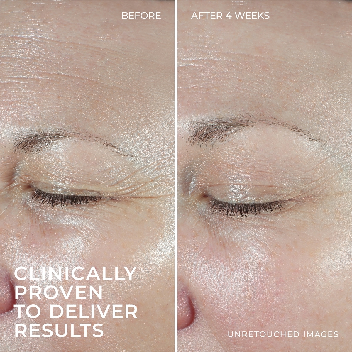 Roc Multi Correxion Hydration Plus Moisturizer 1.7 Oz