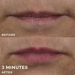 Derm Correxion Lip Volumizer 4