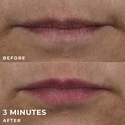 Derm Correxion Lip Volumizer 4