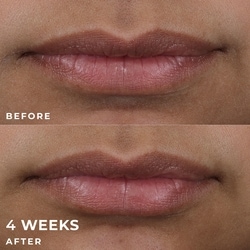 Derm Correxion Lip Volumizer 5