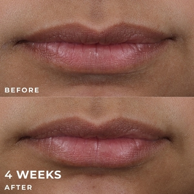 Derm Correxion Lip Volumizer 5