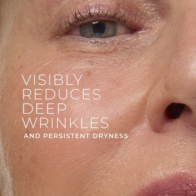 Roc Retinol Correxion Deep Wrinkle Rich Cream 2