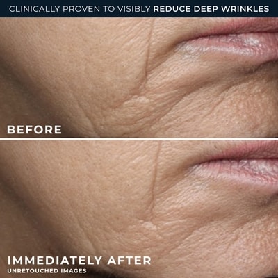 Roc Retinol Correxion Deep Wrinkle Rich Cream 4