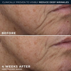 Roc Retinol Correxion Deep Wrinkle Rich Cream 5