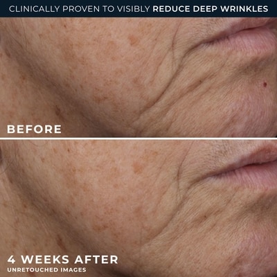 Roc Retinol Correxion Deep Wrinkle Rich Cream 5
