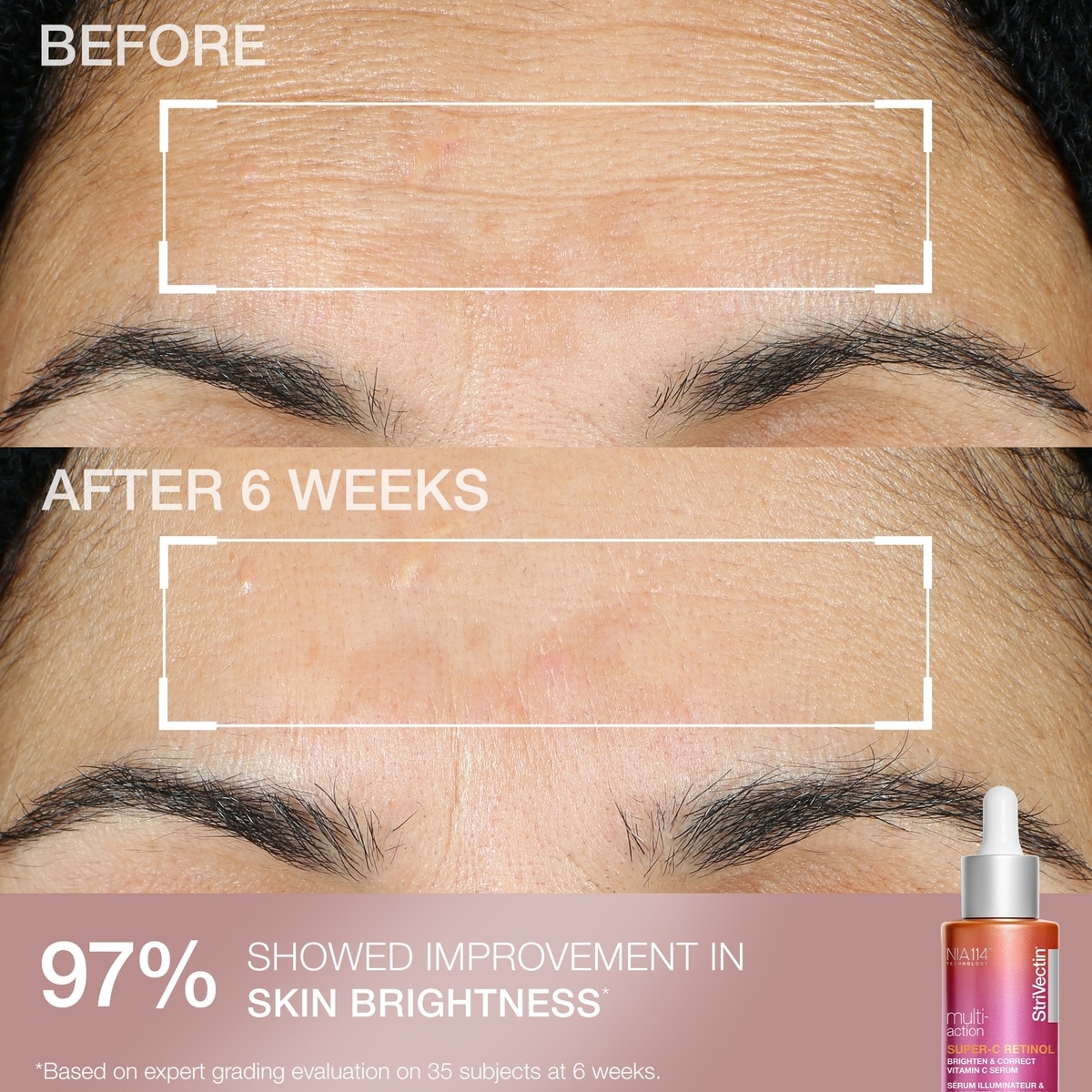 Miniatures Pour La Peau Cliniquement Prouvées