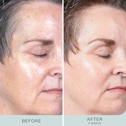 Ceretin Boost Age Defying Retinol Serum 5